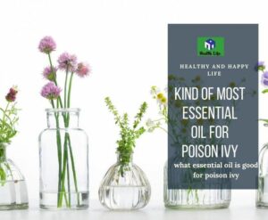 What Essential Oil Is Good For Poison Ivy?